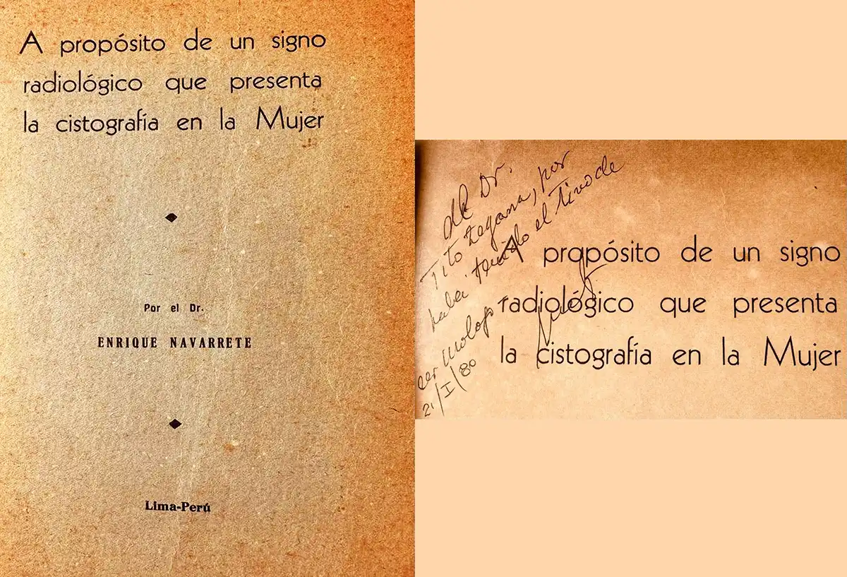 A Propósito de un Signo Radiológico que presenta la Cistografía en la Mujer, Enrique Navarrete (1980)